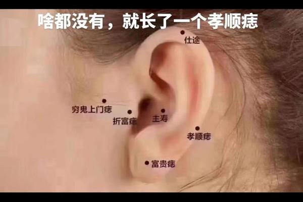 耳部痣相;耳朵有痣的命运 图解