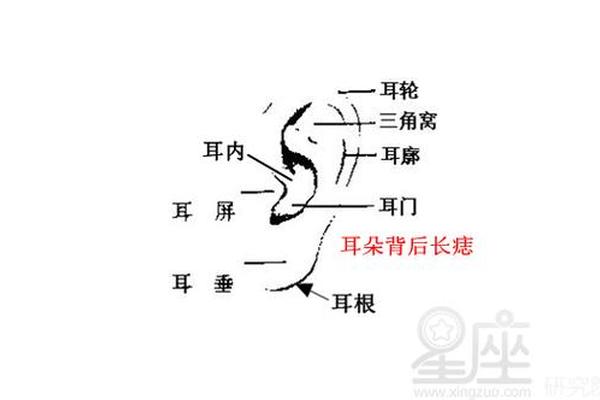 男耳朵痣相算命图解-男人耳朵上的痣好坏图解