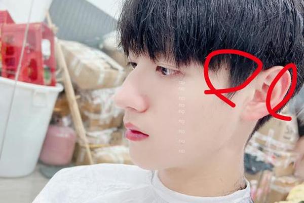 男人右侧鬓角痣相最准图-男人右鬓角头发里有痣