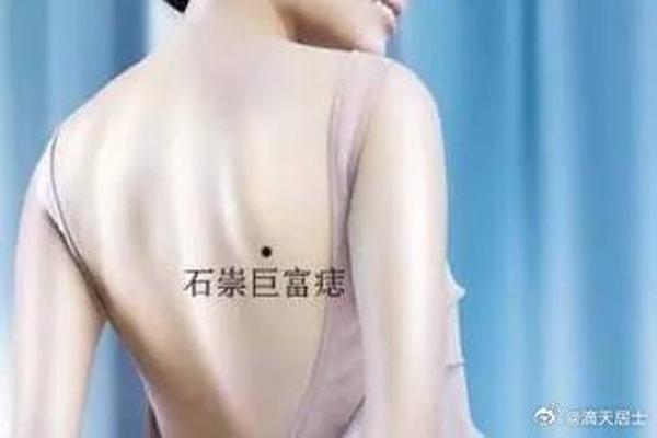 肩胛骨痣相的含义,肩胛骨的痣有什么说法