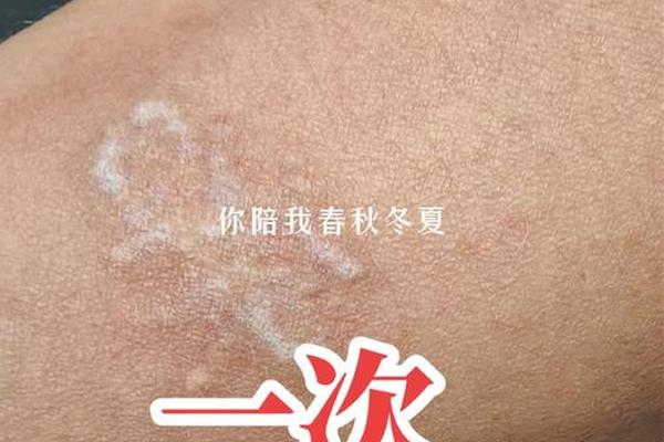 痣相纹身颜色深好吗(洗纹身为什么没变化就是颜色深了)