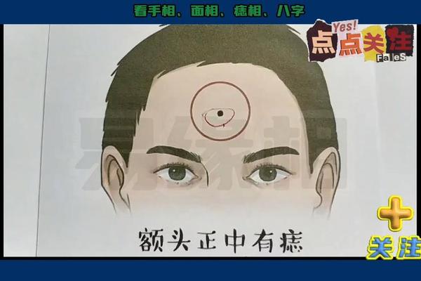 麻衣相法额头有痣好不好、千金难买额头痣