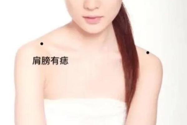 痣相 肩膀,肩膀上的痣是什么痣
