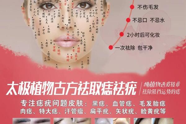女痣相 鼻子_女人痣相图解
