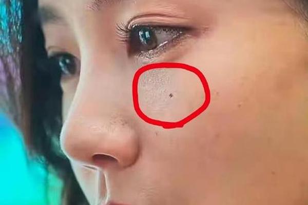 女人下眼睑有痣相_痣位于眼角有怎样的寓意