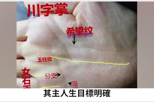 如何看身体痣相、手掌痣相图解