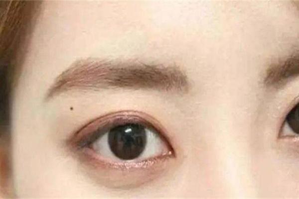 左上眼皮上有痣是什么相 左眼上眼皮长痣好不好