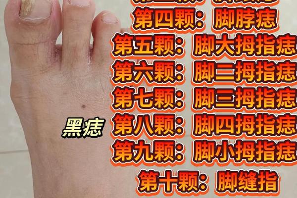 脚上的痣有痣相吗—腿上的痣图解痣相图解 脚上的痣有痣相吗—腿上的痣图解痣相图解