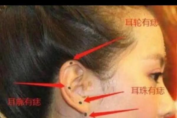 女人耳朵痣的相、耳朵有痣的女人图解