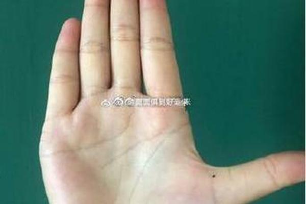 女人左边大拇指痣相、女人左手大拇指有痣代表什么意思