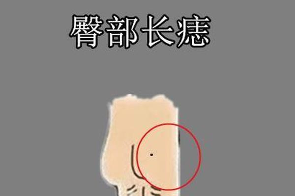 猪屁股痣相;屁股痣相图解10大福痣