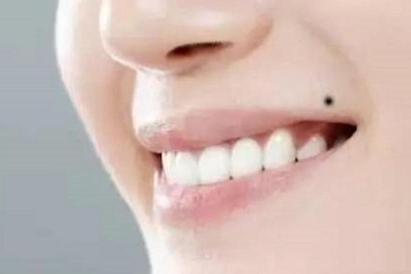 男人上唇有痣相最准图(男人上唇唇珠正中间有痣)