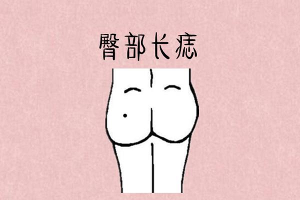 看字相屁股上长痣(屁股上突然长了一个痣)