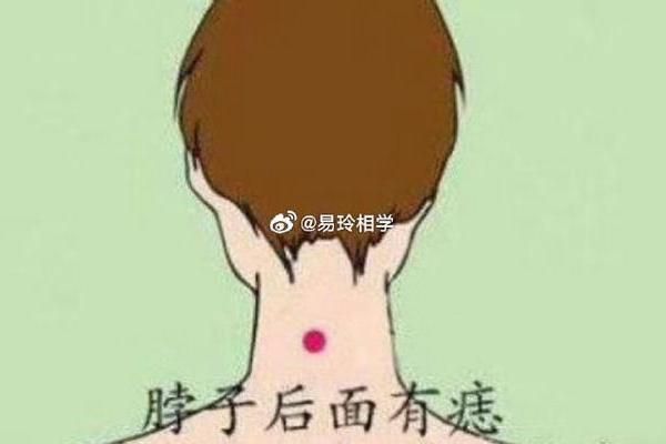 女生后颈痣相;后颈长痣相图解大全