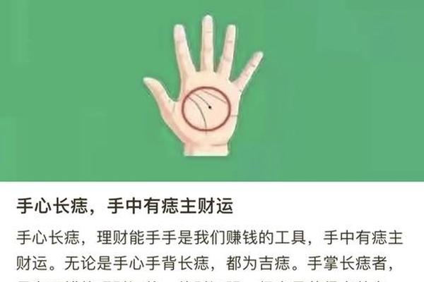 男人左手掌痣相最准图—左手长痣意味着什么