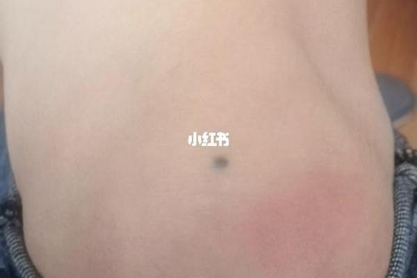 膝盖长了颗痣痣相-左膝盖长了一颗痣