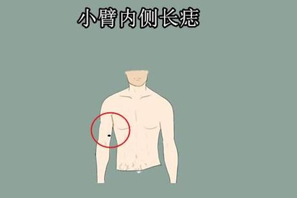 小臂上有痣相-右手臂内侧长痣是什么意思