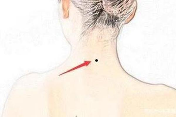 脖子后面有痣相—后脖子痣相图解女人
