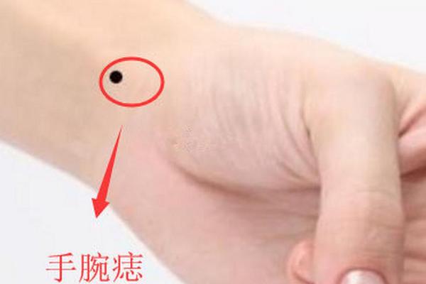女人手臂痣相解析-手掌痣相图解