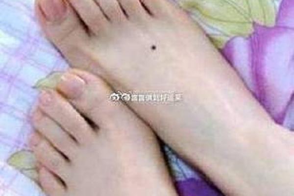 脚背处痣相 脚背痣的位置与命运图解