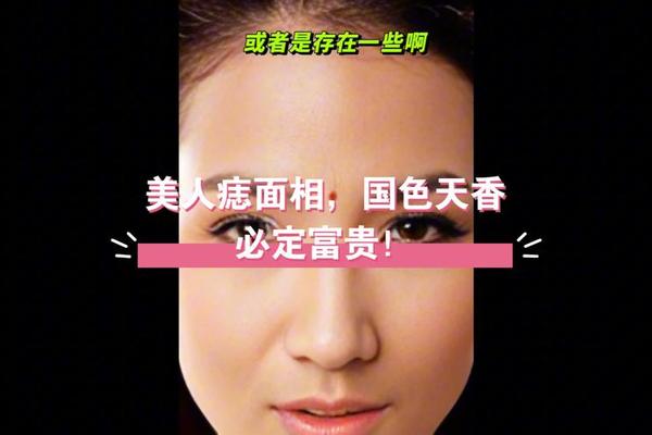 富太太痣相 贵夫人痣