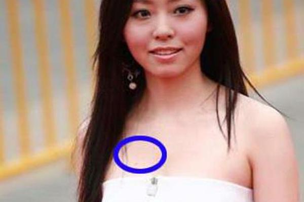 胸部痣相女人(女性有痣好吗)