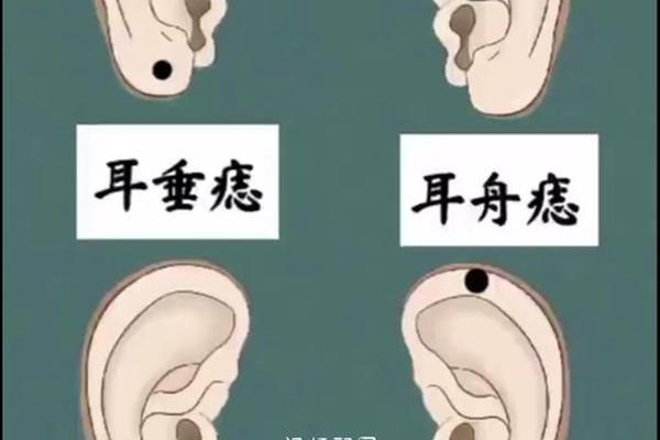女生耳朵长痣的图相;耳朵上长痣图解女人