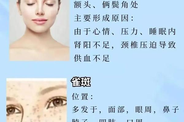 脸上的黑斑算痣相吗(脸上黑点算不算是痣)