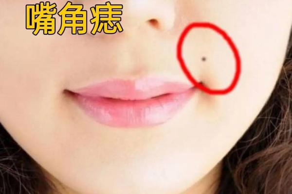 长在嘴角上的痣相(左嘴角长痣)