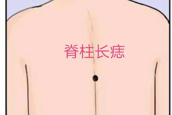 腰上痣相-腰侧痣相图解