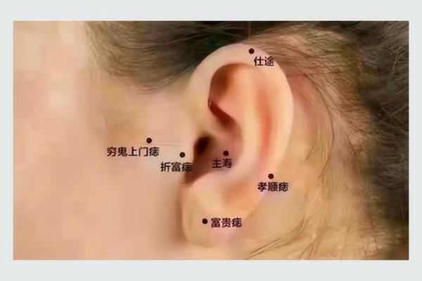 麻衣神相后脑有一颗痣 耳朵有痣的命运 图解