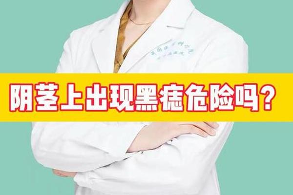 痣相男小鸡有痣(男人小鸡上长痣好不好) 痣相男小鸡有痣(男人小鸡上长痣好不好)