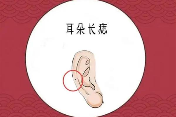 男孩耳痣相 男孩耳朵上有痣好吗