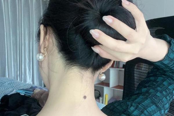 脖子后面痣相—脖子后面的痣图片