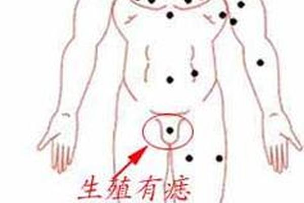有痣有相、男人生殖上长痣好不好 有痣有相、男人生殖上长痣好不好