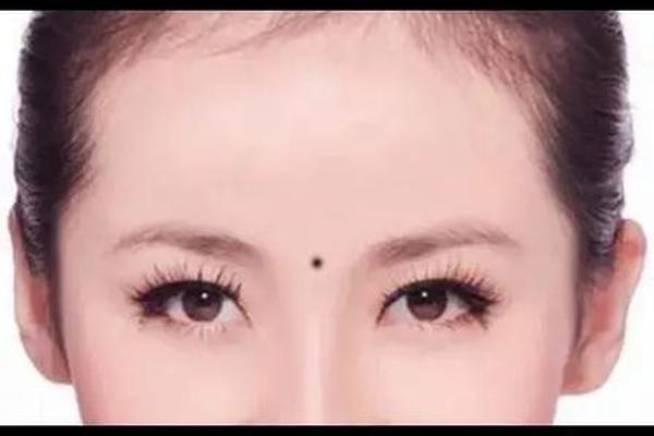 眉心长痣是帝王之相吗,眉心痣长在哪里图片