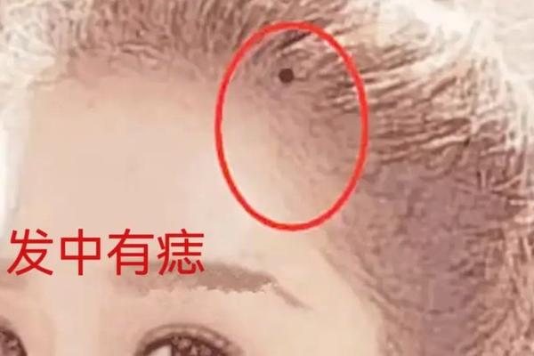 必定巨富的痣相-巨富痣大概在什么位置 必定巨富的痣相-巨富痣大概在什么位置