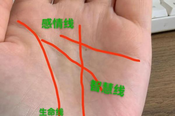 手相和痣相怎么看男女_手相痣图解大全男
