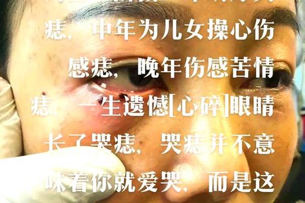 女性流泪痣相(女生泪痣的正确位置)