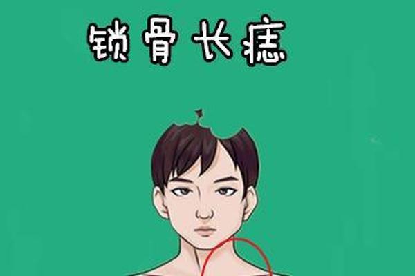 颈部有痣相_颈部长痣好不好