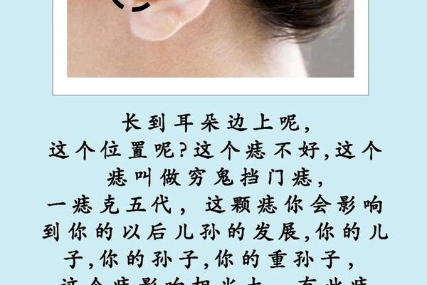 女人的耳朵痣相—耳屏有痣的女人