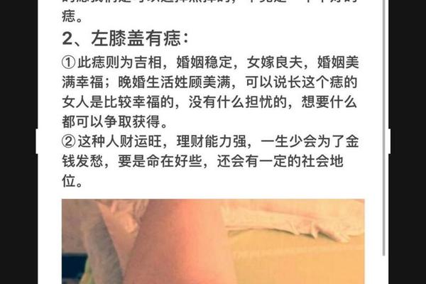 左大腿痣相;左大腿长痣面相的注意事项 左大腿痣相;左大腿长痣面相的注意事项
