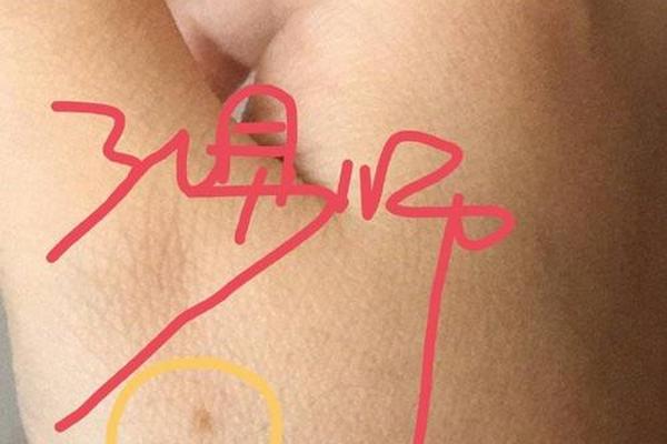 男人左手虎口痣相—左手虎口有痣的男人命好吗