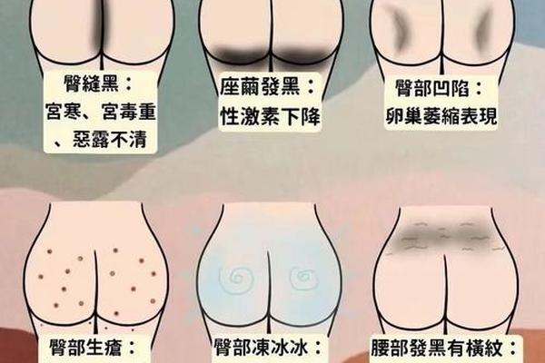 屁股两边有痣之痣相详解—屁股痣相图解10大福痣