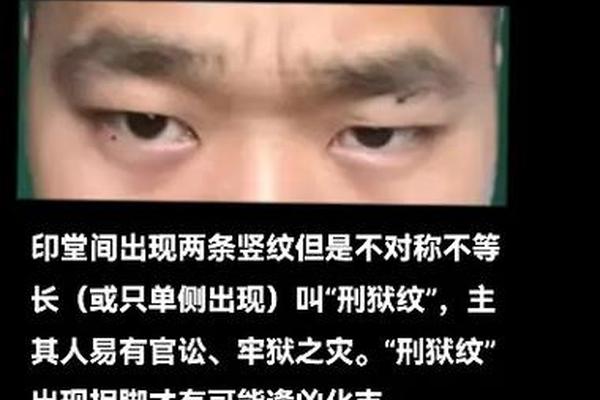 牢狱之灾的痣相-人有牢狱之灾的征兆