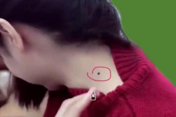 女人脖子后痣相最准图_脖子左后方有痣的女人