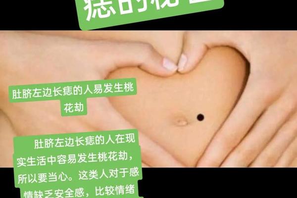 肚脐左边痣相解析、手掌痣相图解 肚脐左边痣相解析、手掌痣相图解