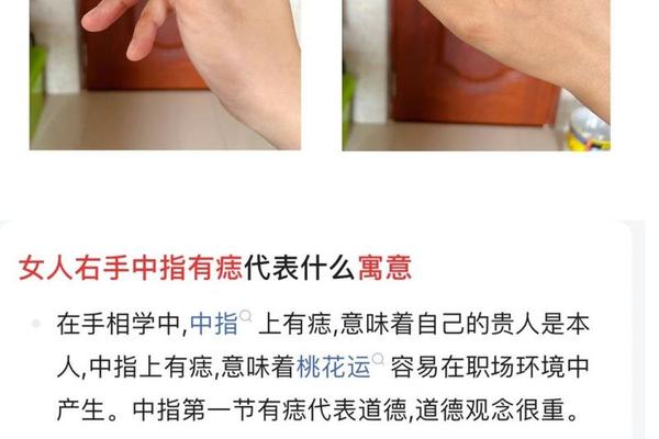 手指有痣相 右手中指长痣代表什么