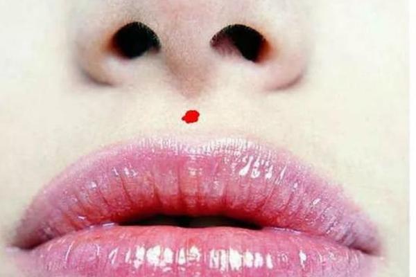 痣相双生花图片;女人双生痣