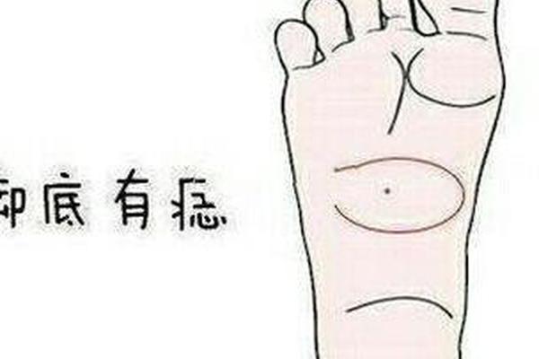 帝王脚相有痣图解大全、脚长痣位置与命运图解法